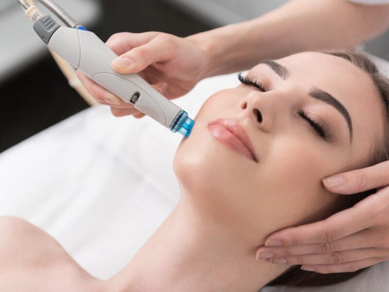 Mesotherapie met fillers in Javea